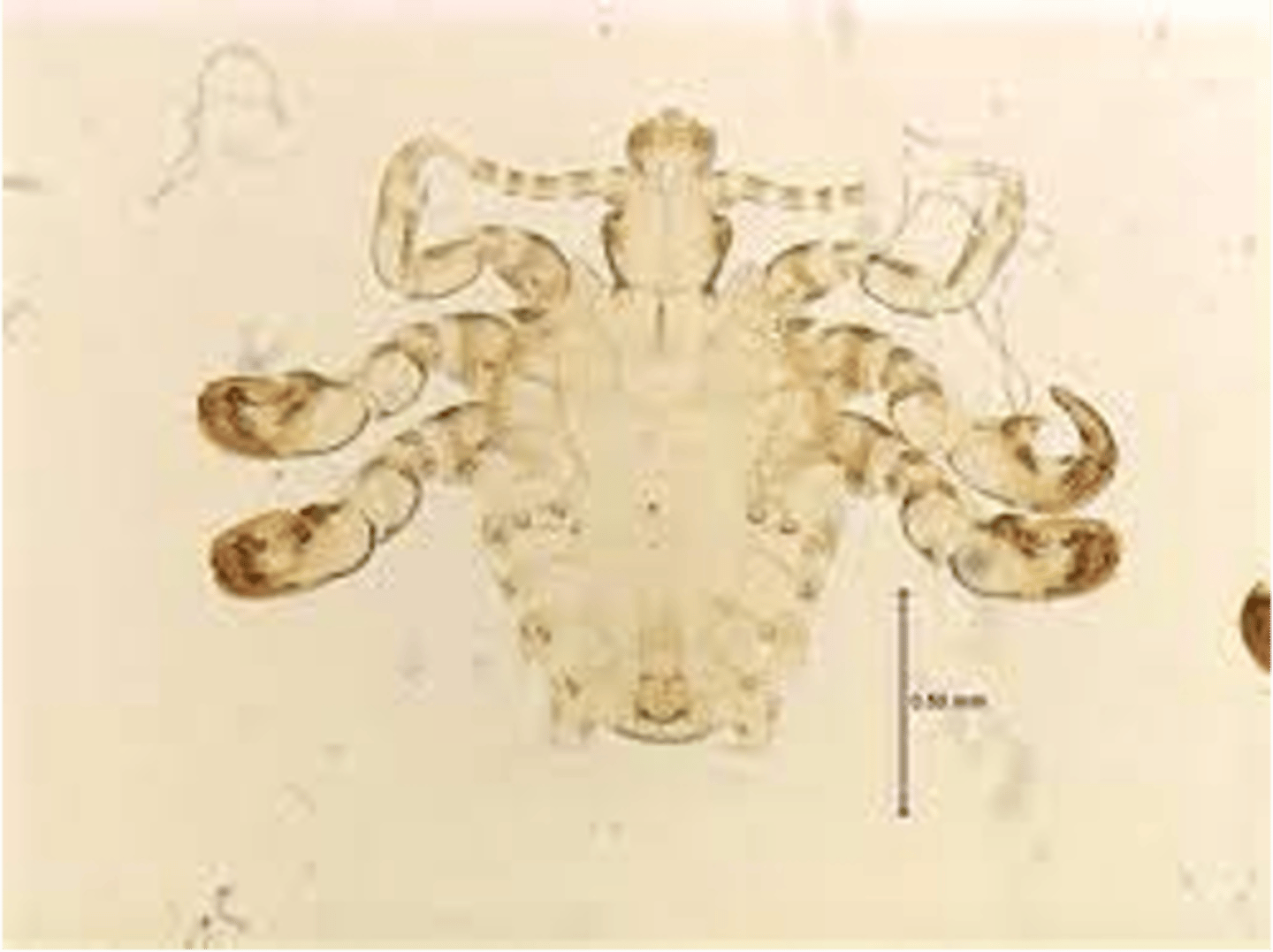 <p>6 legs, have hooks, look like crabs, found in pubic hair, eyebrows , eyelashes, is sexually transmitted</p>