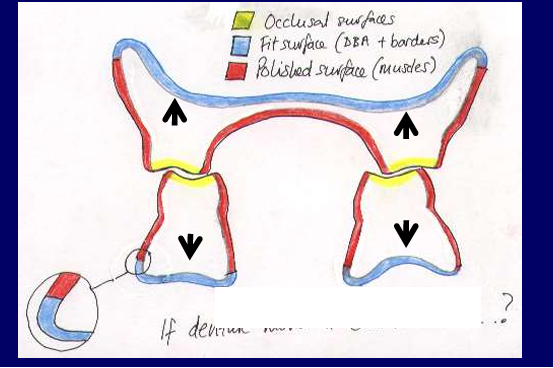 <p><strong>Resistance of a denture to displacement</strong> (movement) t<strong>owards the tissues</strong> (especially when subjected to occlusal loads on teeth)</p>