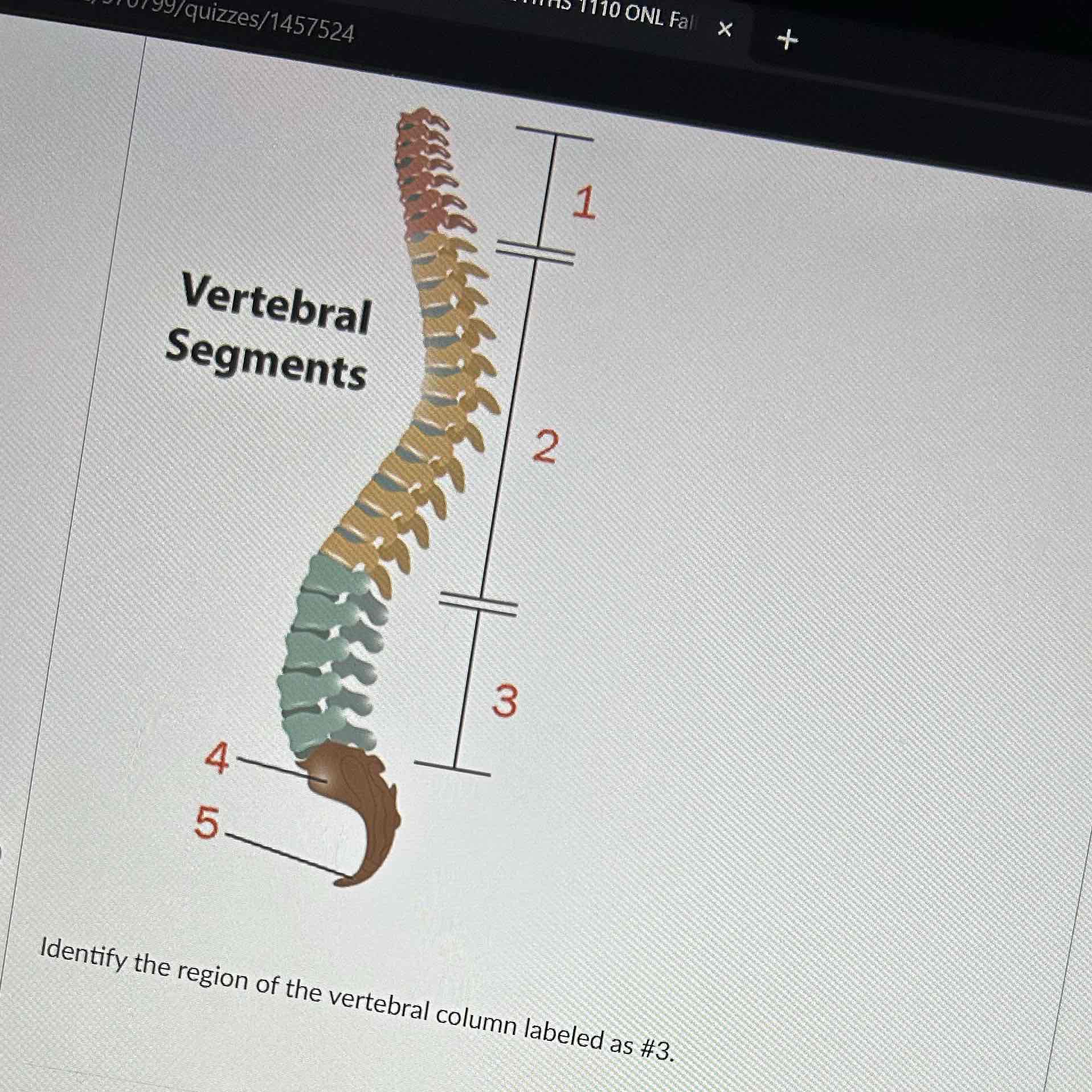 <p>Identify the region of the vertebral column labeled as #3</p>