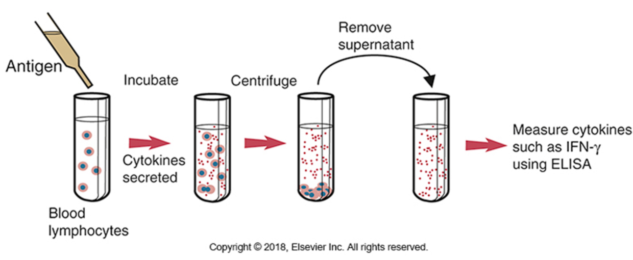 <p><span><span>The release of IFN-γ by peripheral blood lymphocytes following exposure to tuberculin or to purified mycobacterial antigens. This technique can be used for the diagnosis of tuberculosis in cattle and deer. Tuberculin PPD is added to blood, and the mixture is incubated for 24 to 48 hours. The plasma is then removed and assayed for any interferon produced.&nbsp;</span></span></p>