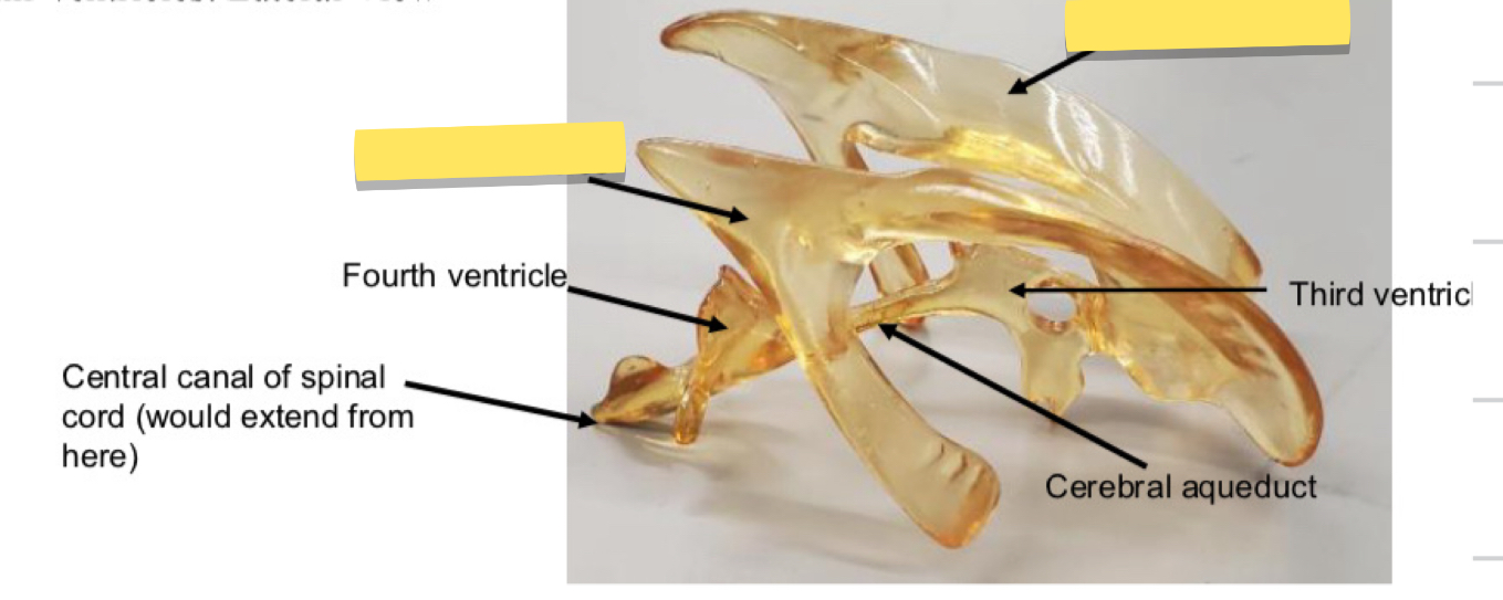 <p>Name this brain ventricle</p>