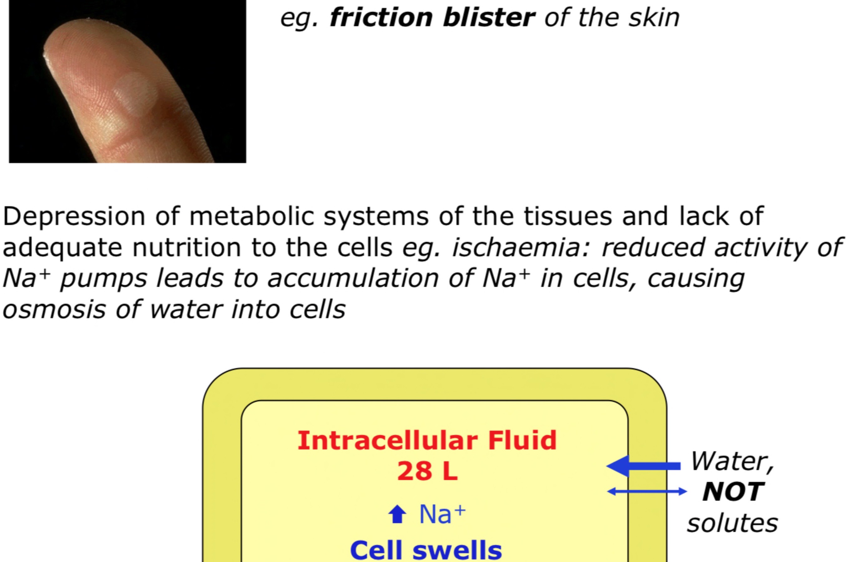 → cells and interstitial fluid, cells can’t retain water 