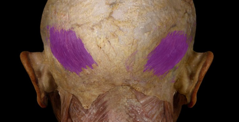 <p>back of head, where occipital bone is</p>