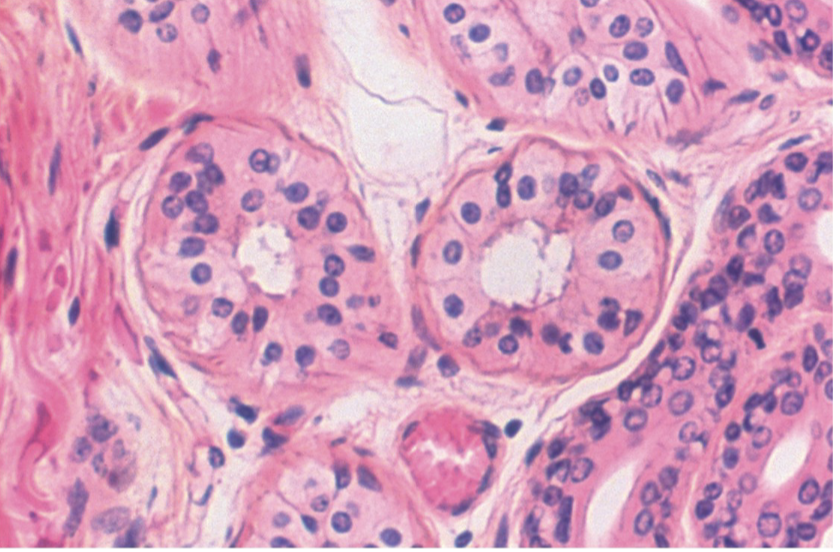 <p>Stratified Cuboidal Epithelium</p>