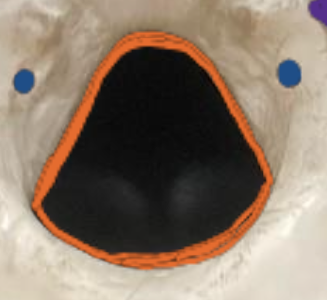 <p>Holes that look like they are inside of the Foramen magnum</p>