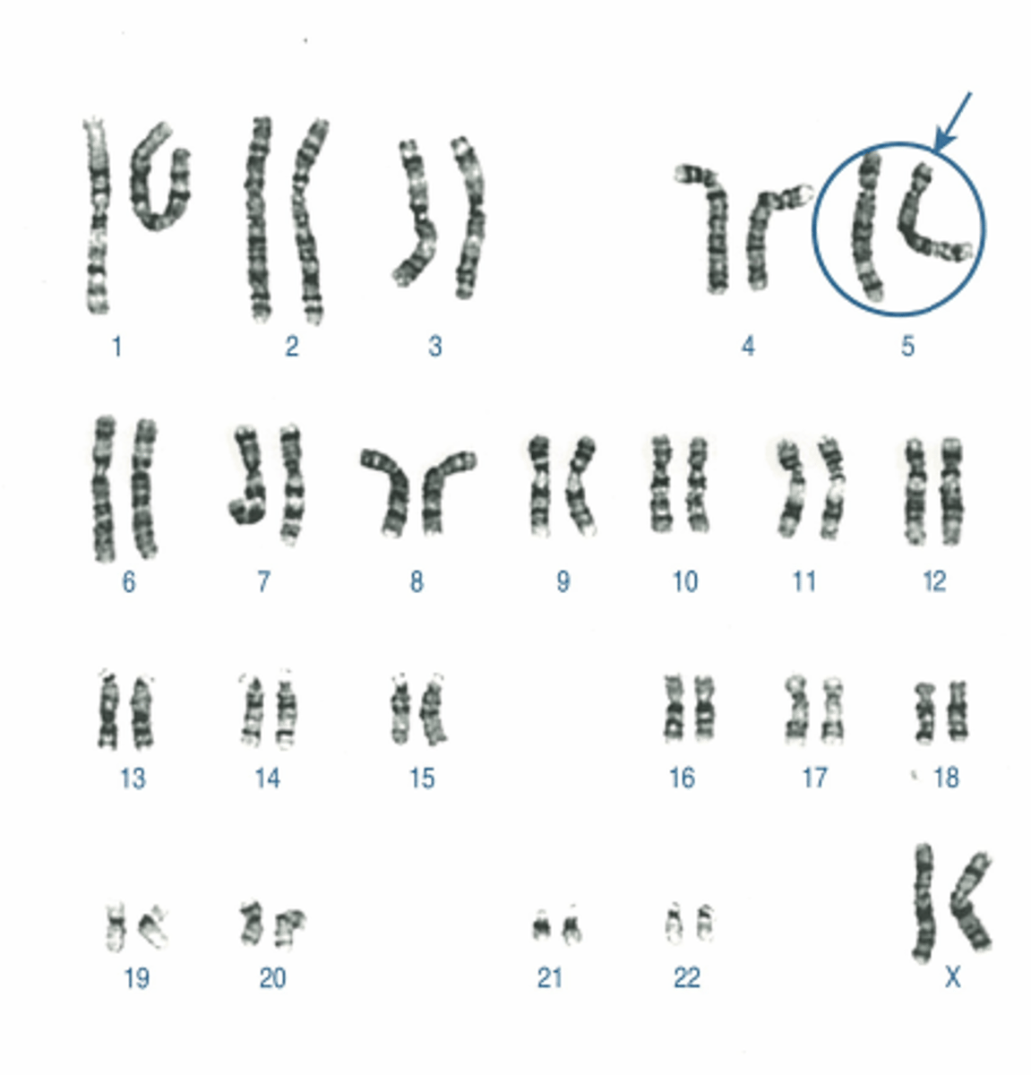 <p>Name:</p><p>- Correctly written karyotype</p><p>- Common name</p><p>- Scientific name</p><p>- One distinguishing clinical feature</p><p>- Definition of this feature if not obvious</p>