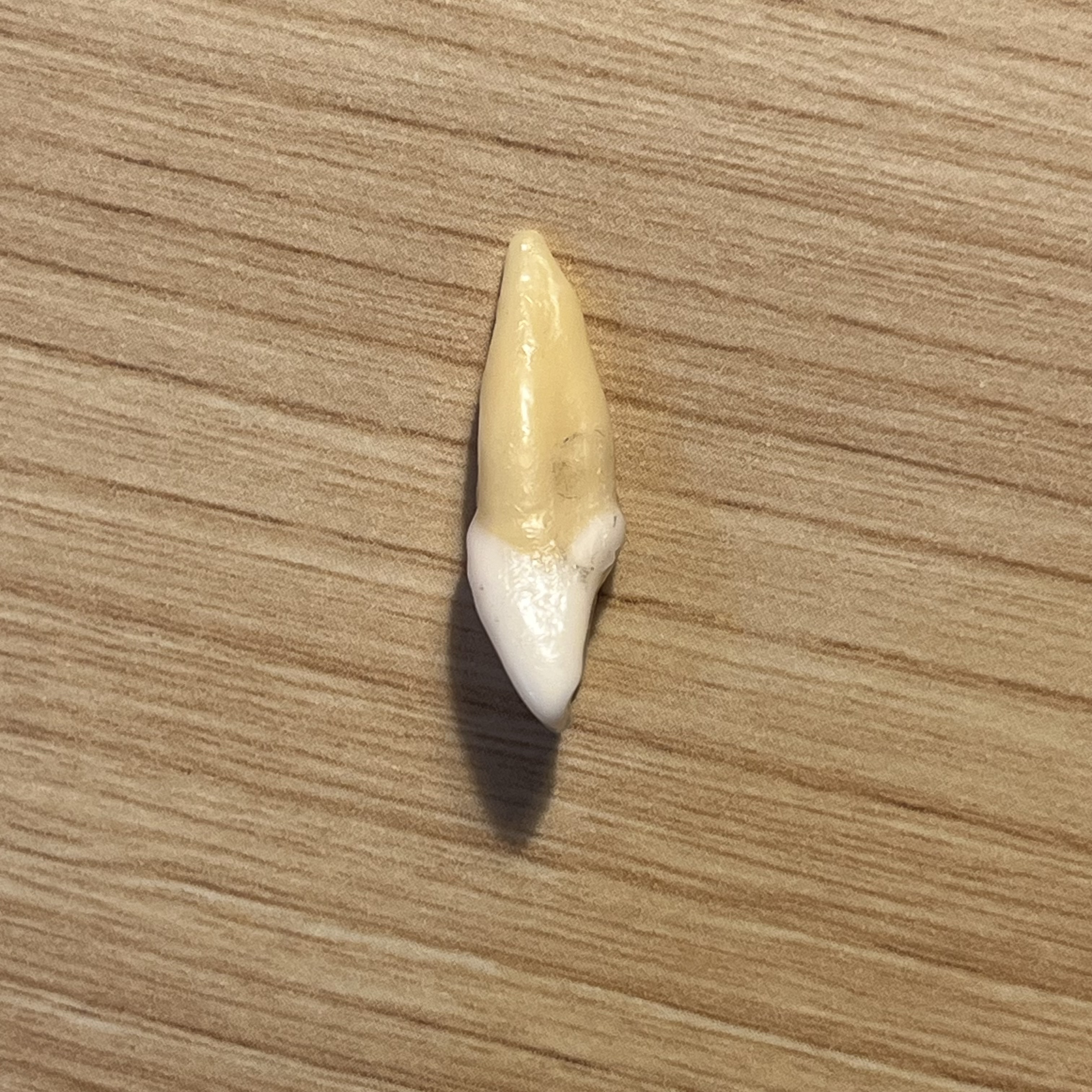 <p>What tooth is this (with view)?</p>