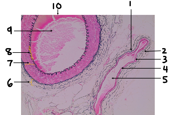 <p>Label structures 6-10</p>