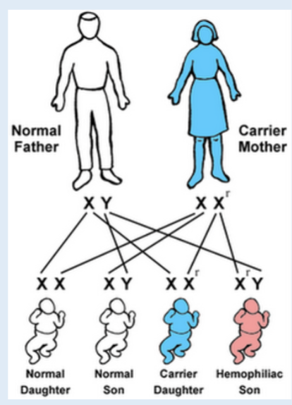 <p>what is haemophilia caused by?</p>