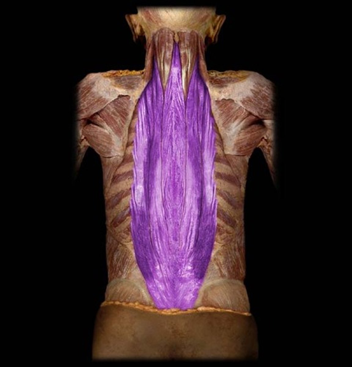 <p>muscles that line the vertebrae</p>