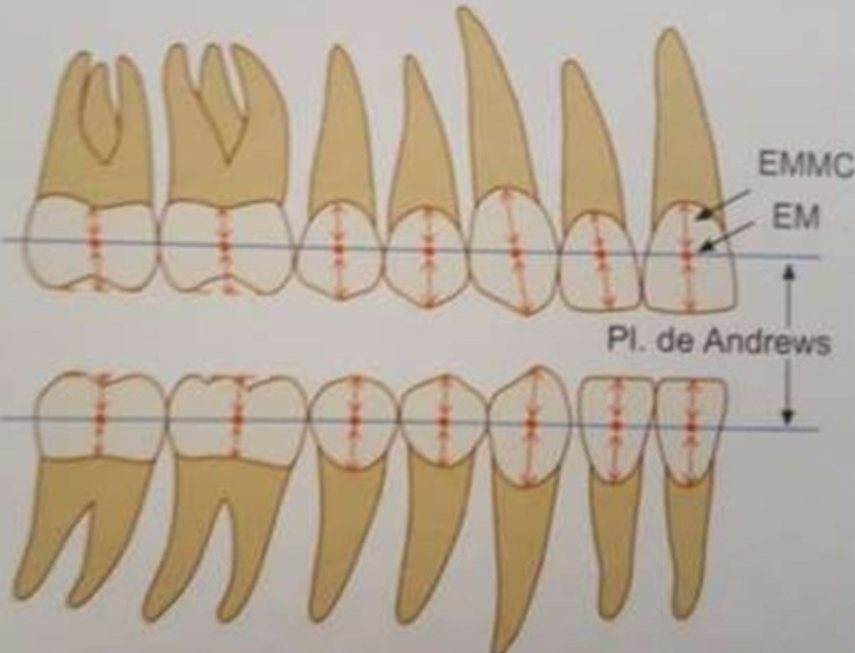 <p>Mid transverse plane of every crown will ideally be consistent when every tooth in the arch is aligned </p>