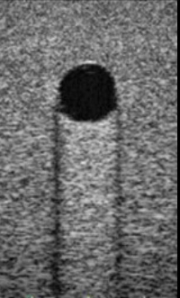 Identify the echogenicity
