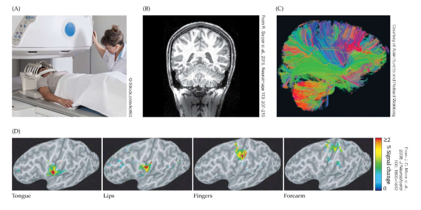<p>X-rays, computerized tomography (CT), Positron emission tomography (PET), MRI, Diffusion-tensor imaging (DTI), fMRI</p>