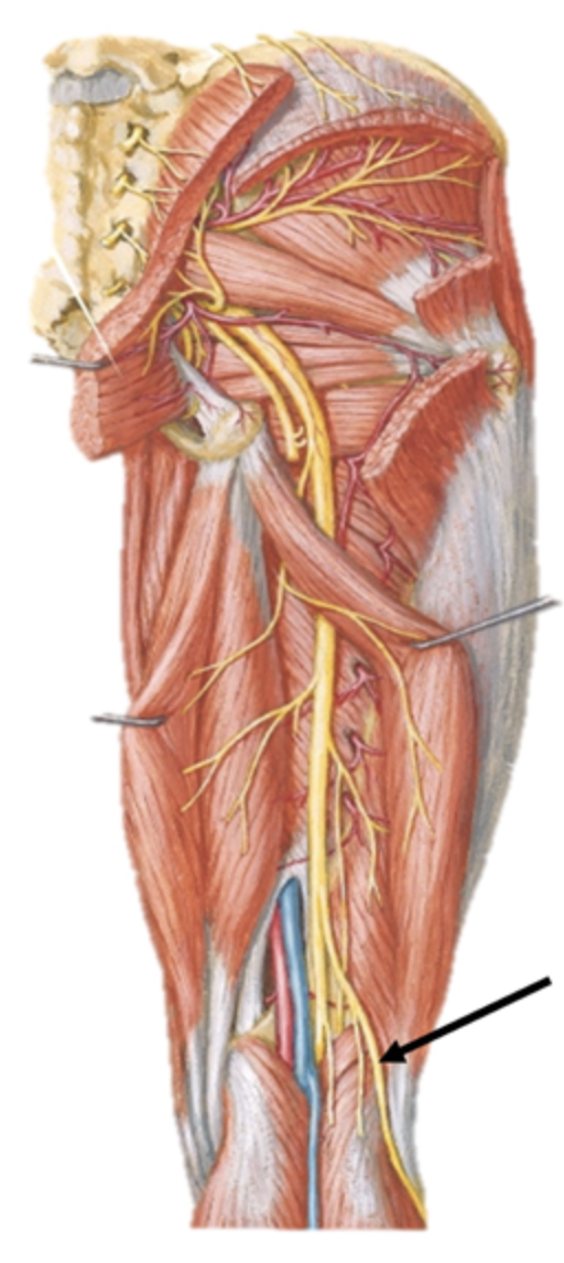 <p>External compression of this nerve (indicated in the diagram below) by a plaster cast may lead to the weakness of which of the following muscles?</p>