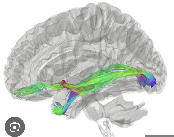 <p>connects the right and left temporal lobes and right and left olfactory bulbs</p>