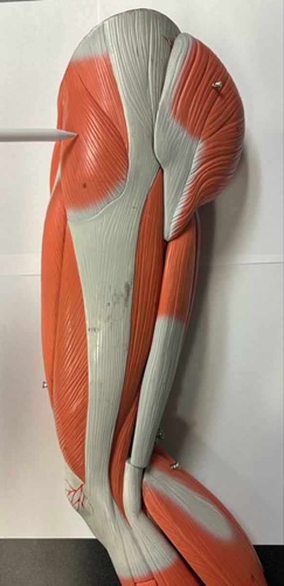 <p>What are the (3) attachments of the Tensor Fasciae Latae?</p>