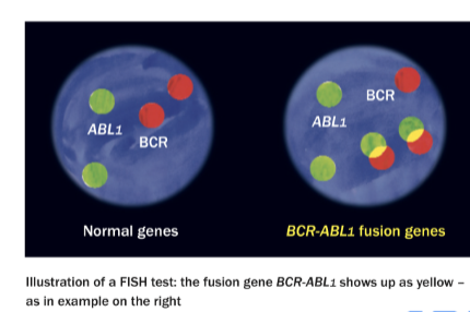 <ul><li><p>Translocation between chr 9 and 22 (Philadelphia chromosome) assoc with CML</p></li><li><p>Detected by hybridization with BCR and ABL probes</p></li></ul><p></p>