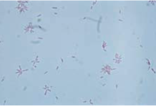 <ul><li><p>Facultative anaerobe</p></li><li><p> Pleomorphic, gram variable</p></li><li><p> <strong>Rosette or flower-like arrangement on Gram stain</strong></p></li><li><p> Alpha-hemolysis</p></li></ul><p></p>