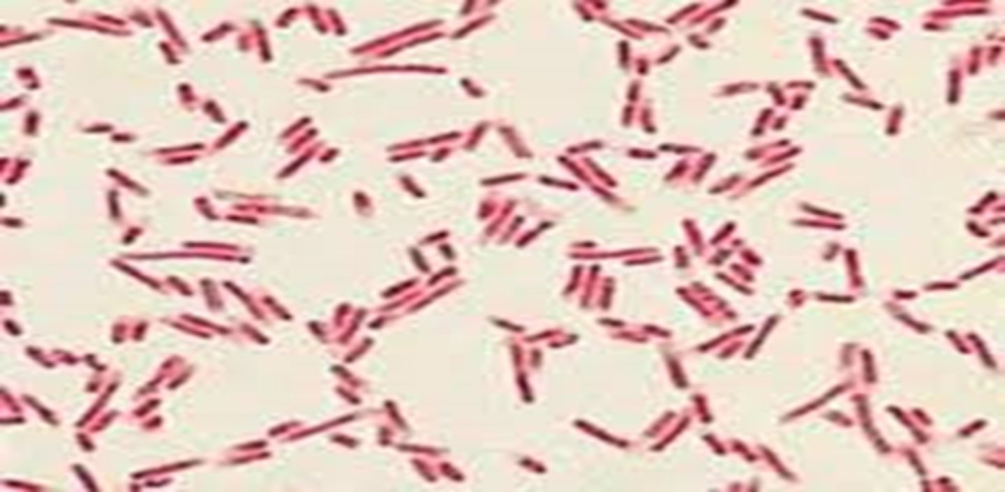 <p>- bacilli (rods)</p><p>- pink = negative</p><p>- arrangement: streptobacilli, staphylobacilli, diplobacilli</p>