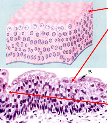 <p>what is this epithelial tissue </p>