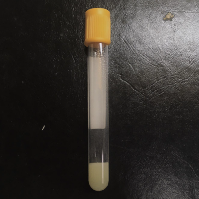 <p>This evacuated tube is used as an alternative evacuated tube to what evacuated tube for a primary analyte in the serum to be preserved?</p>