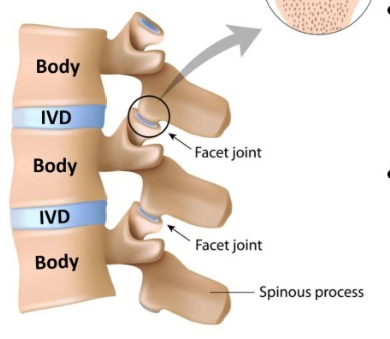<p>-intervertebral joints/discs: between the bodies of adjacent vertebrae (anteriorly), absent between C1 and C2 but present between all vertebrae below C2 onwards</p><p>-facet joints: between adjacent vertebrae via articular processes (posteriorly)</p>