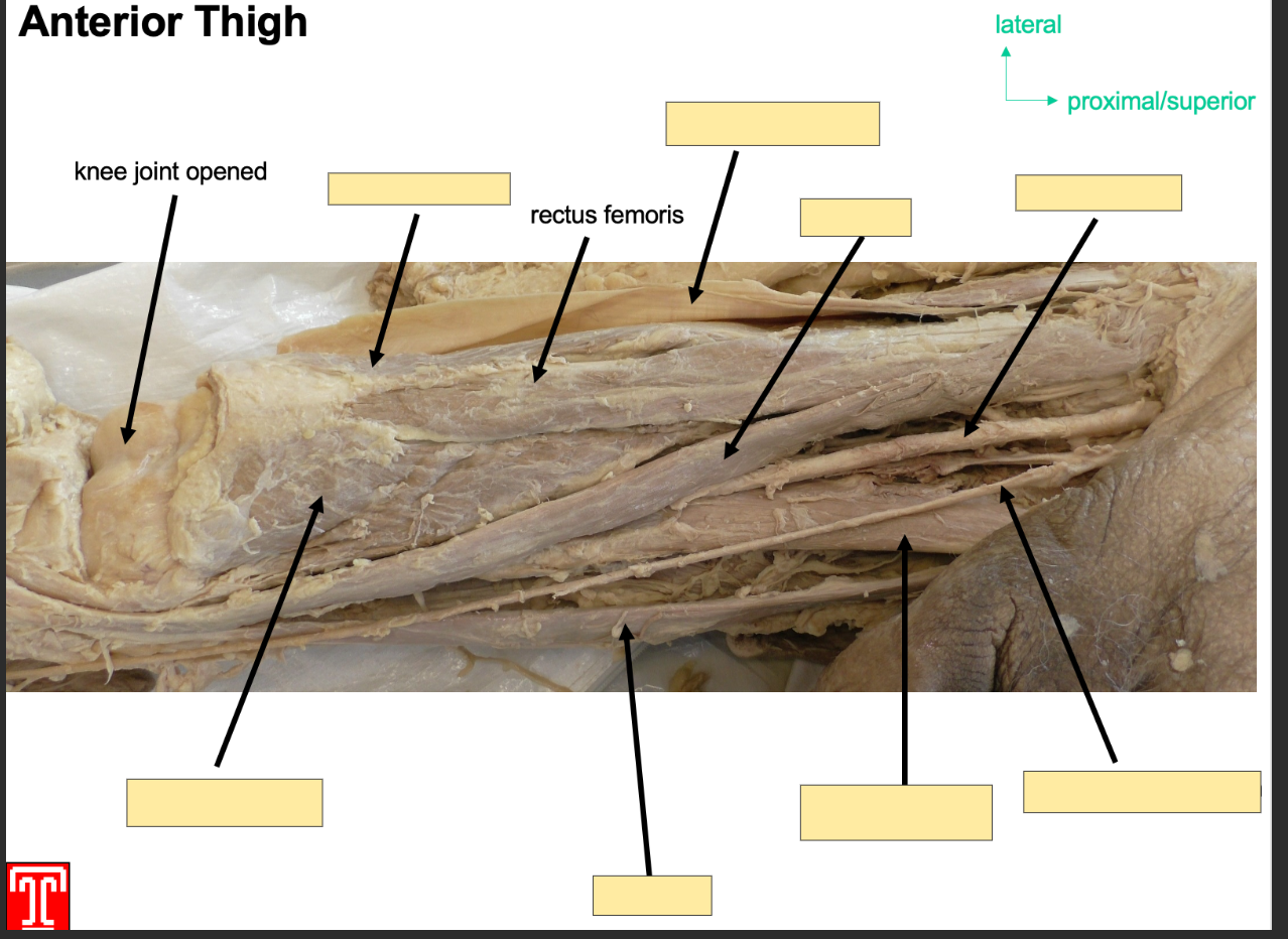 <p>Anterior Compartment, part of the quadriceps </p><p></p><p>Attachment: two heads, 1 head originates from anterior inferior iliac spine</p><p></p><p>2nd head orginates from acetabelur groove of ilium</p><p></p><p>both heads converte into 1 tendon which attaches to patella </p><p></p><p>Action: Extention of knee joint and flexion of hip joint</p><p></p><p>Innervation: femoral Nerve </p><p>Artery: femoral Artery </p><p></p>