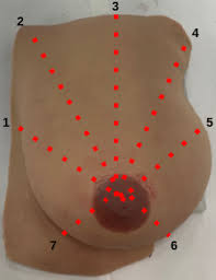 <p>What is the wedge (spokes) palpation pattern?</p>