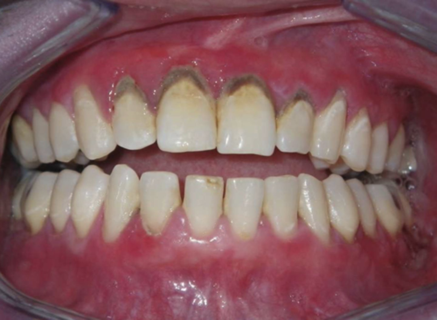 <p>What condition?</p>