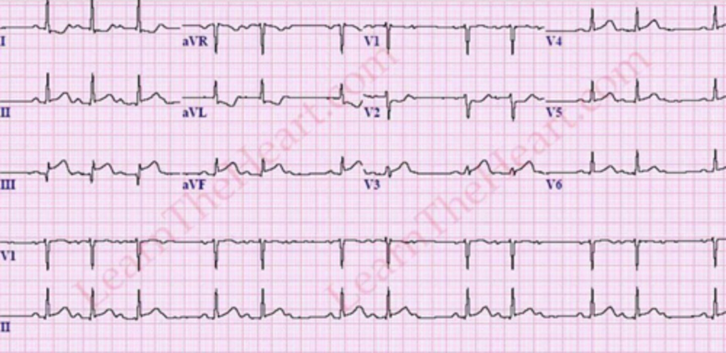 <p>What are the findings</p>