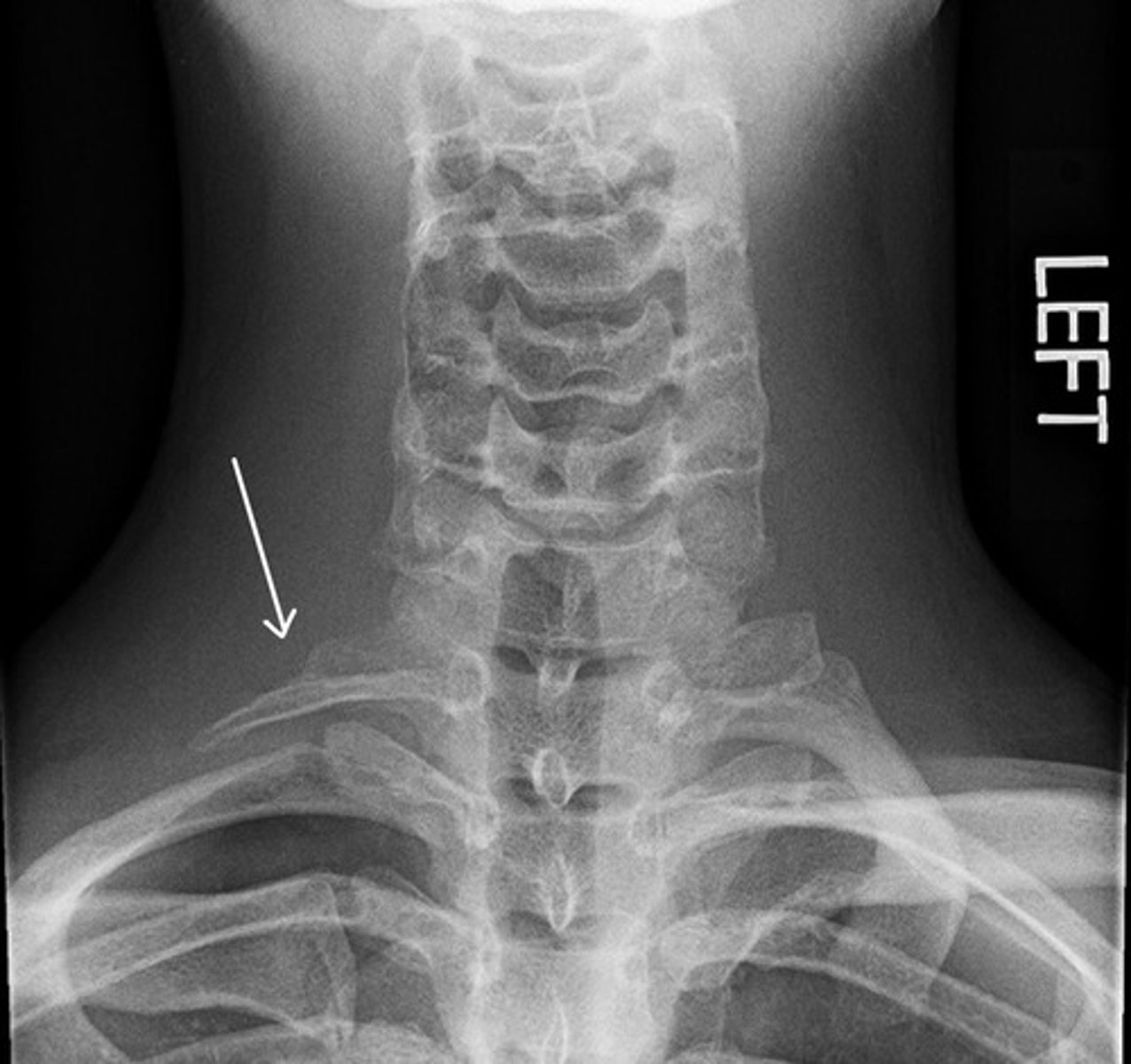 <p>What are we looking at here?</p>