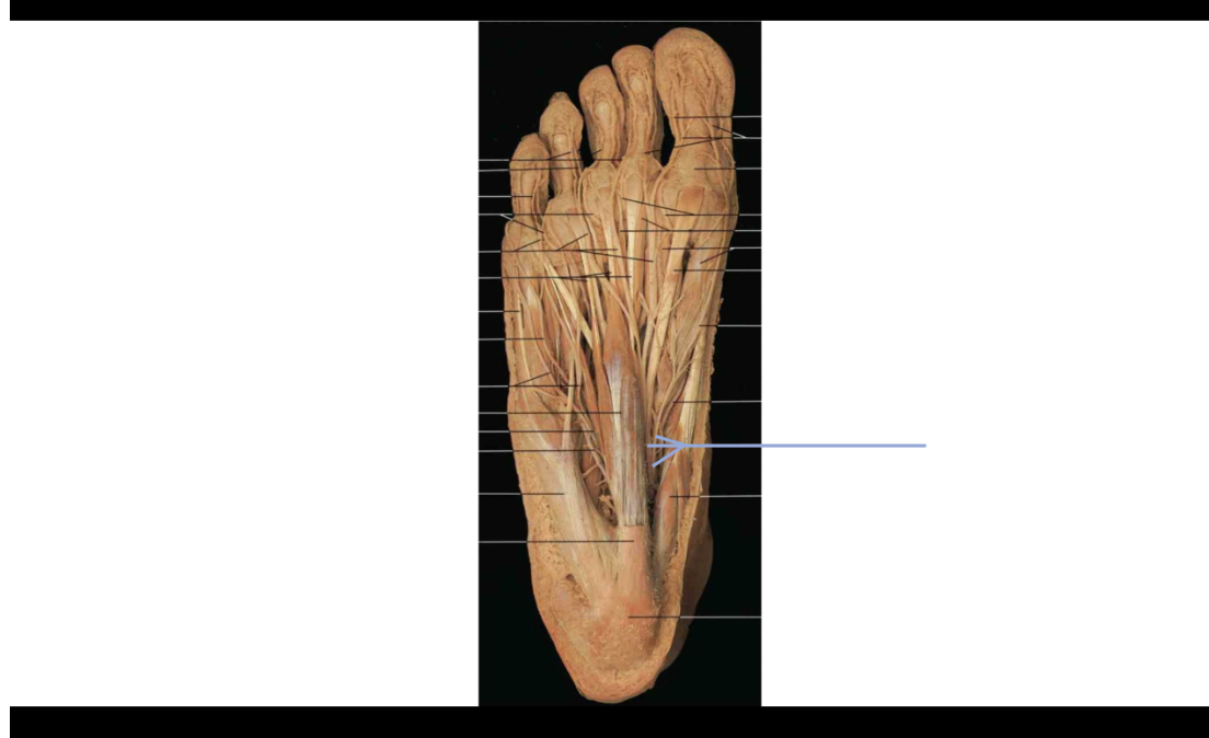 <p>What muscle would lose motor function if this nerve were severed?&nbsp;</p>