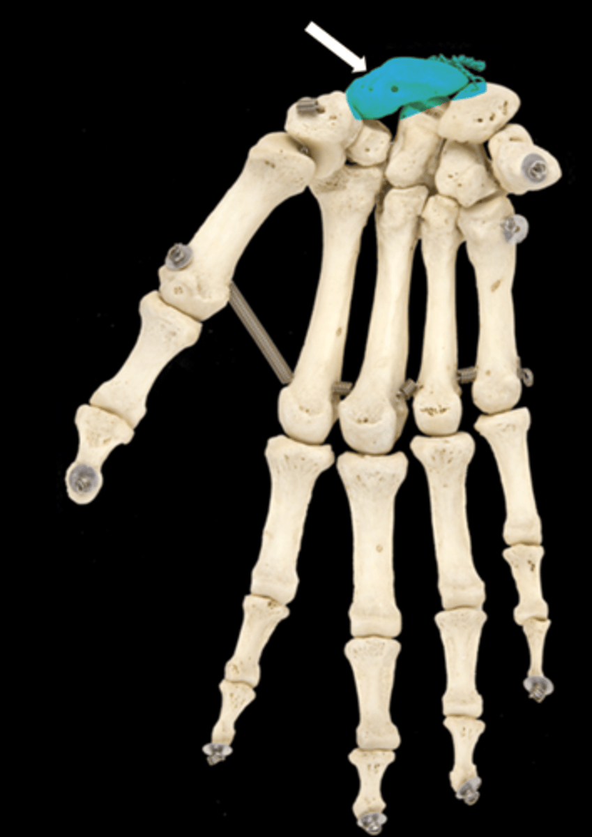 <p>name the part</p>