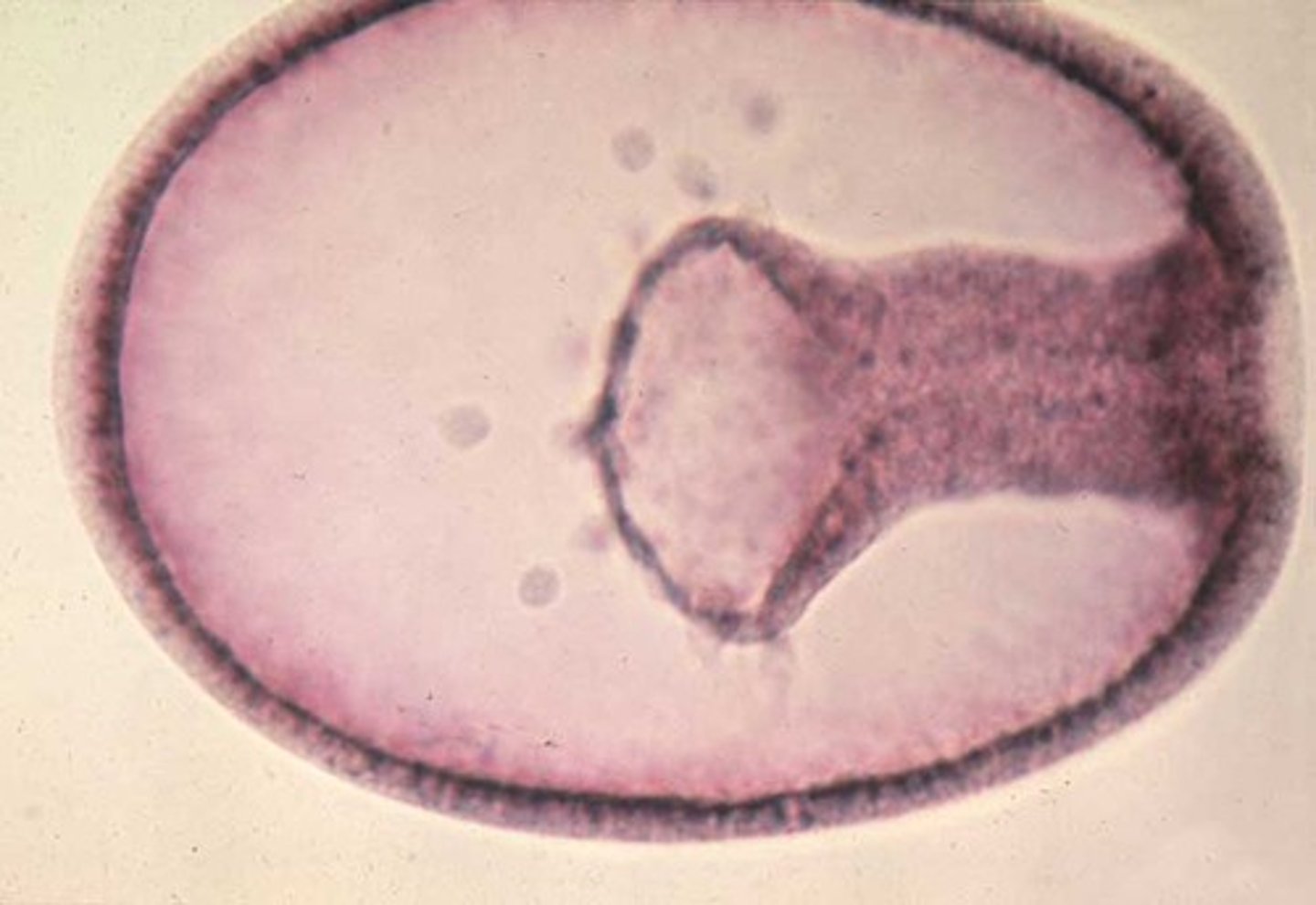 <p>a multilayered embryo; its structure suggests a common ancestry with other organisms</p>