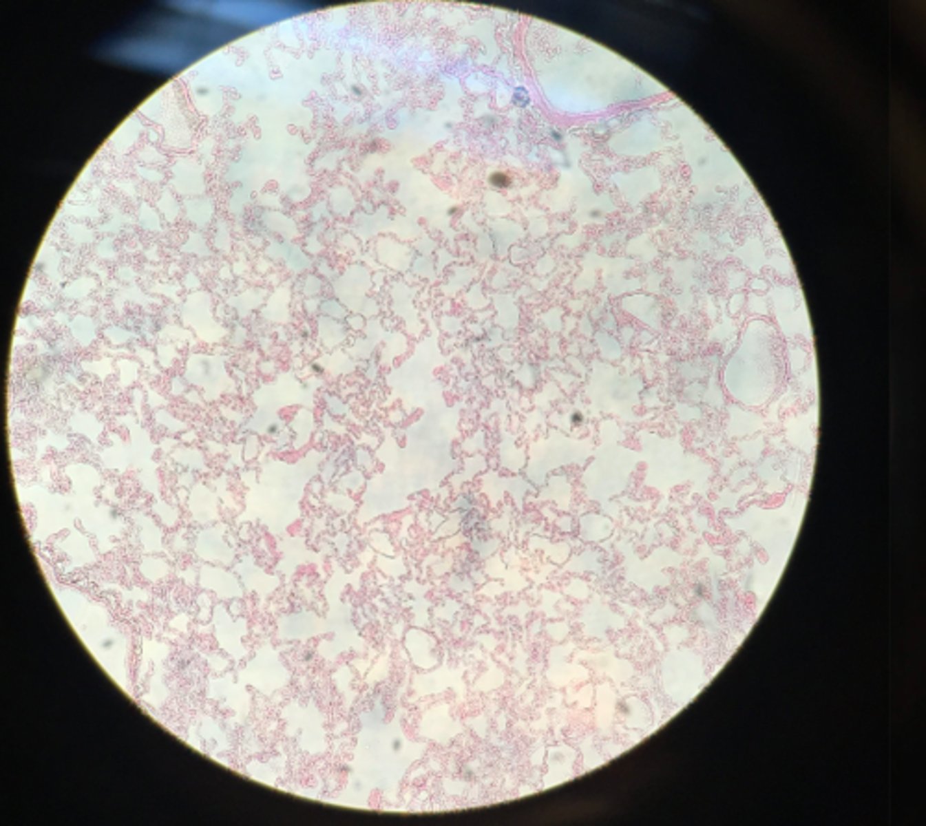 <p>What type of tissue is depicted on this microscope slide?</p>