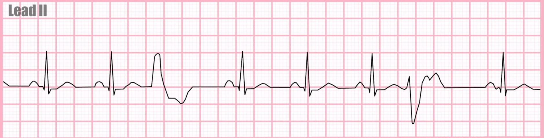 <p>What rhythm is this?</p>