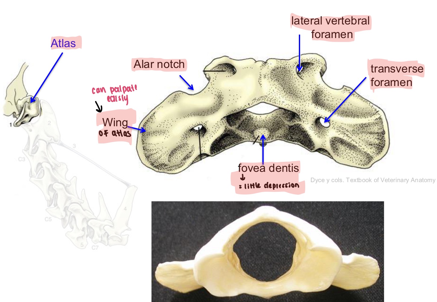 <p>Atlas (C1), cervical vertebra (C7)</p>