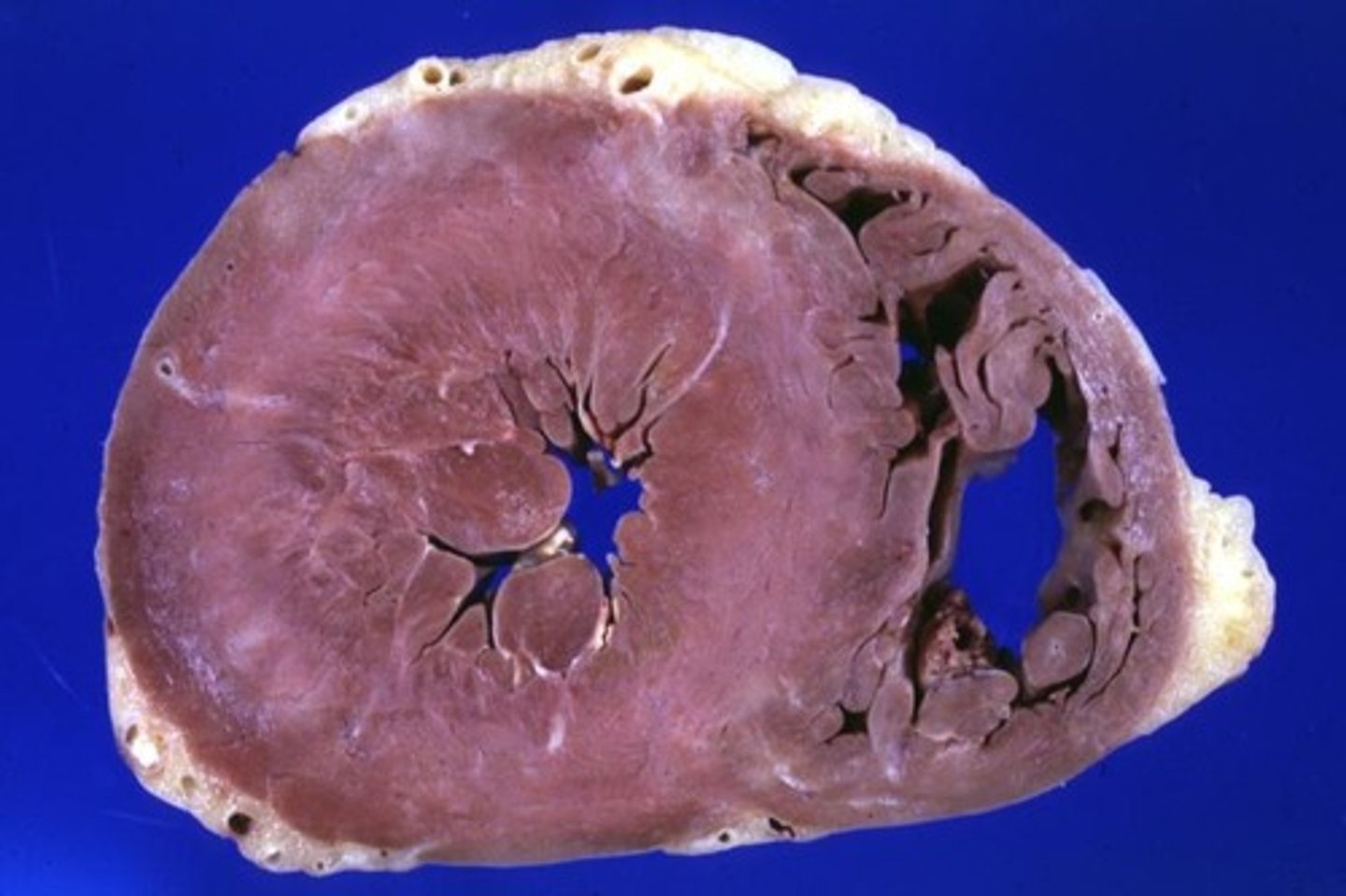 <p>pathologic process involved</p>