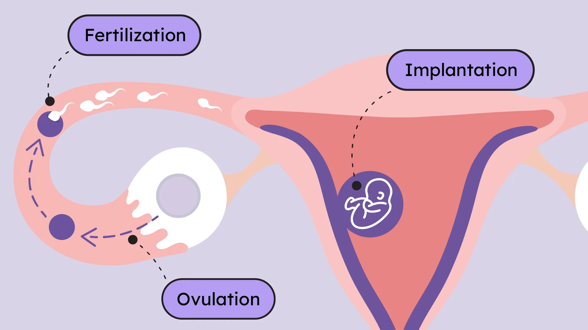 <p>Implantation</p>
