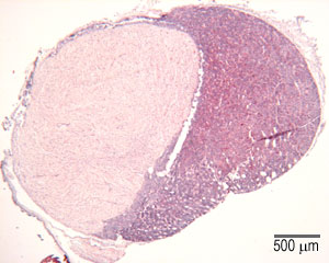 <p>Pituitary Gland</p>