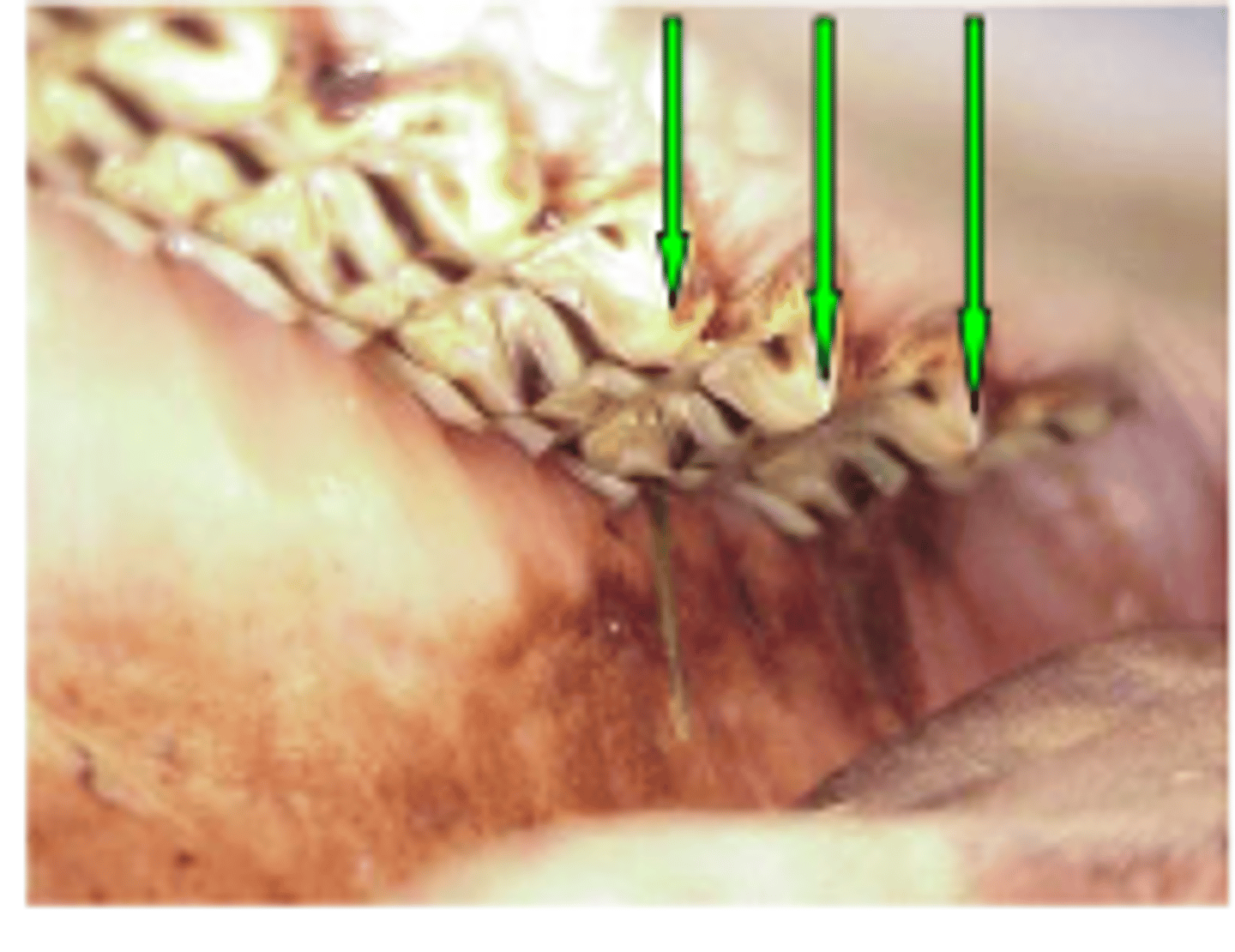 <p>What is the pathology</p>