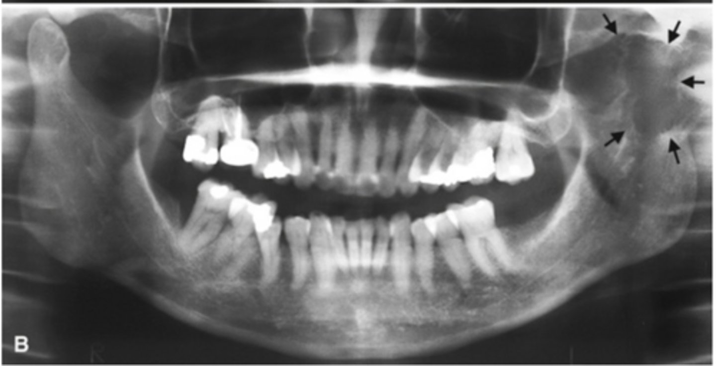 <p>Images shows?</p>