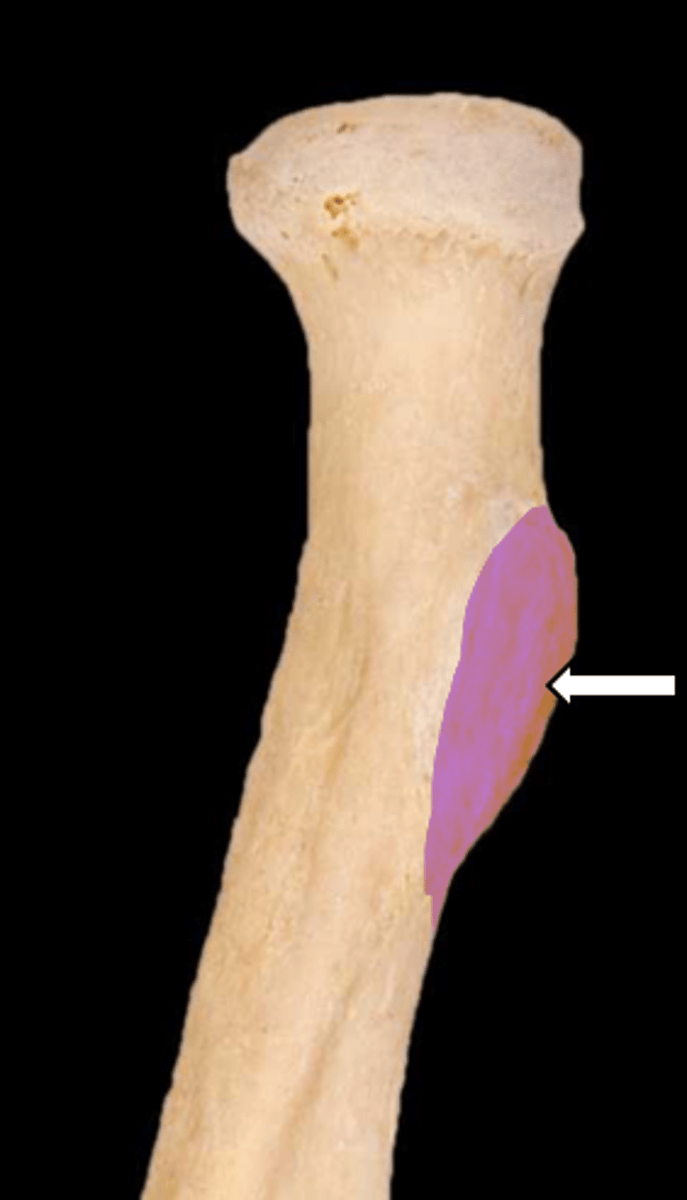 <p>name the part</p>