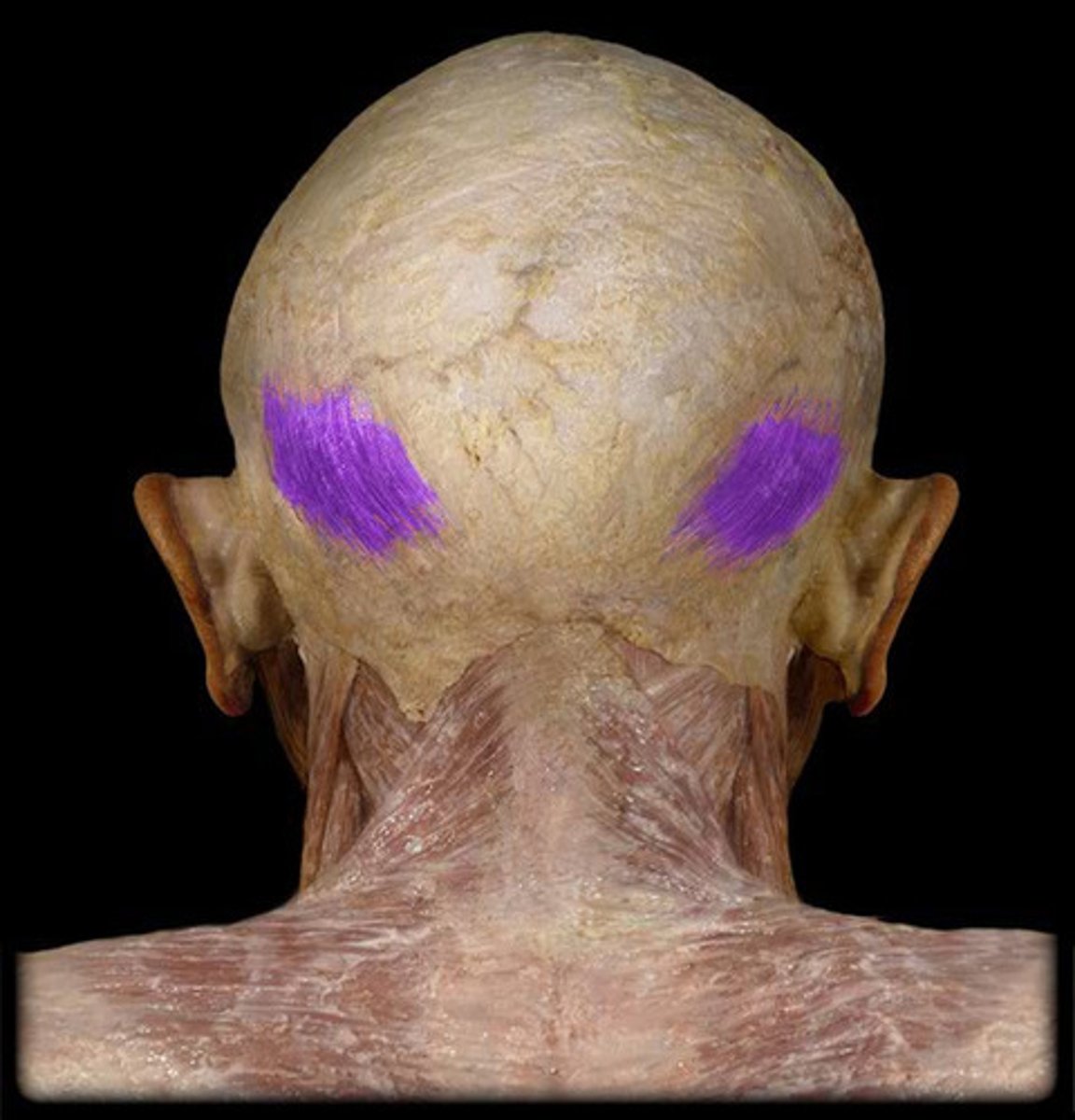 <p>moves scalp backwards (as part of epicranius muscle-elevation of eyebrows, creases forehead)</p>