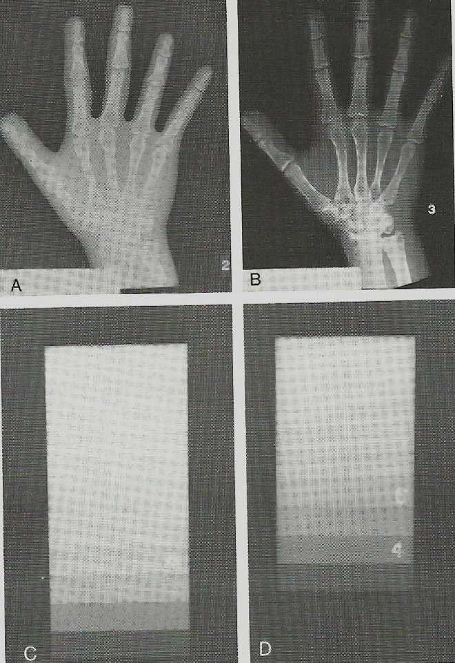 <p><span>radiographic density</span></p>