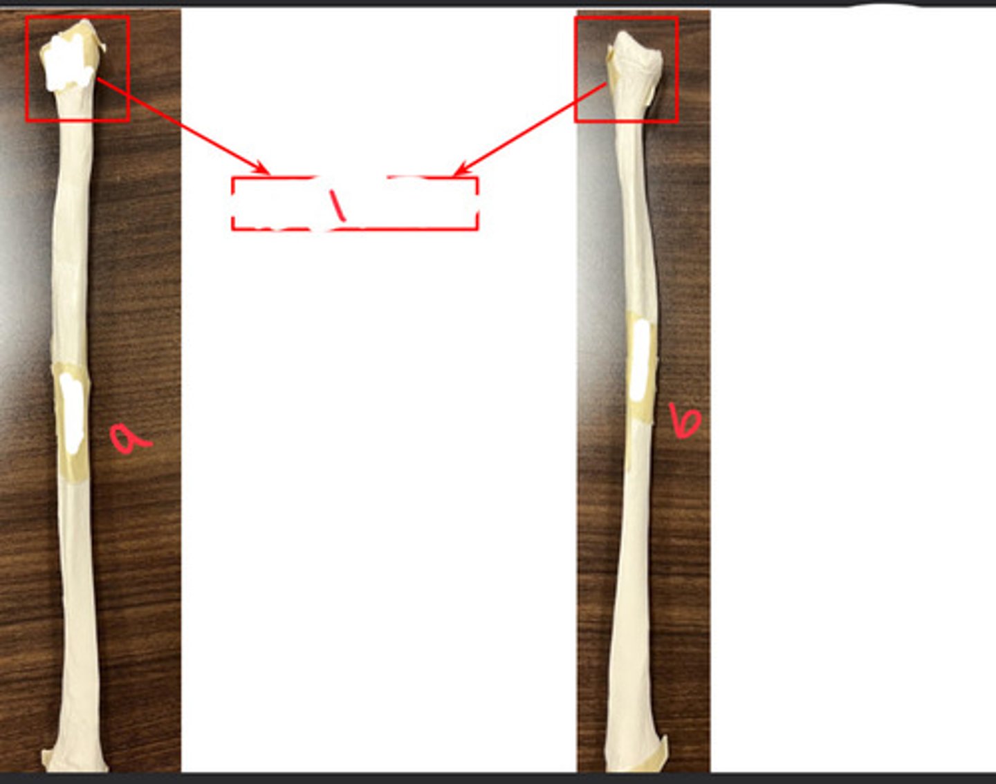 <p>which view of the fibula is a?</p>