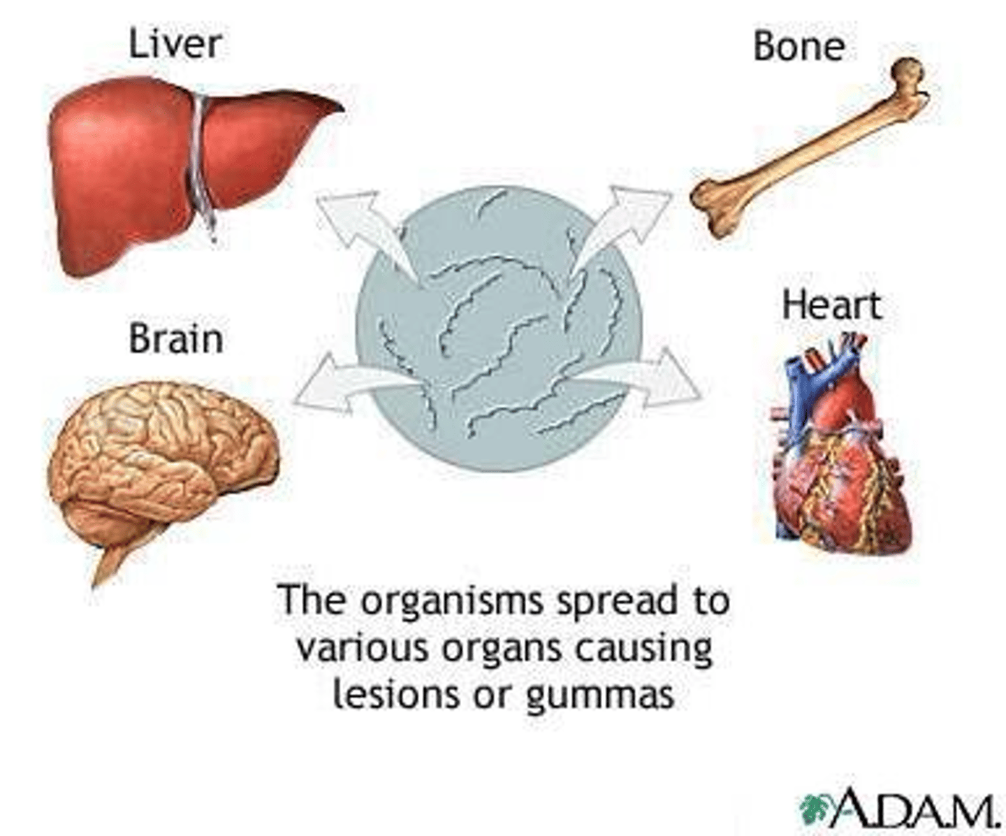 <p>Soft non-cancerous growths that appear 3-10 years after primary infection.</p>