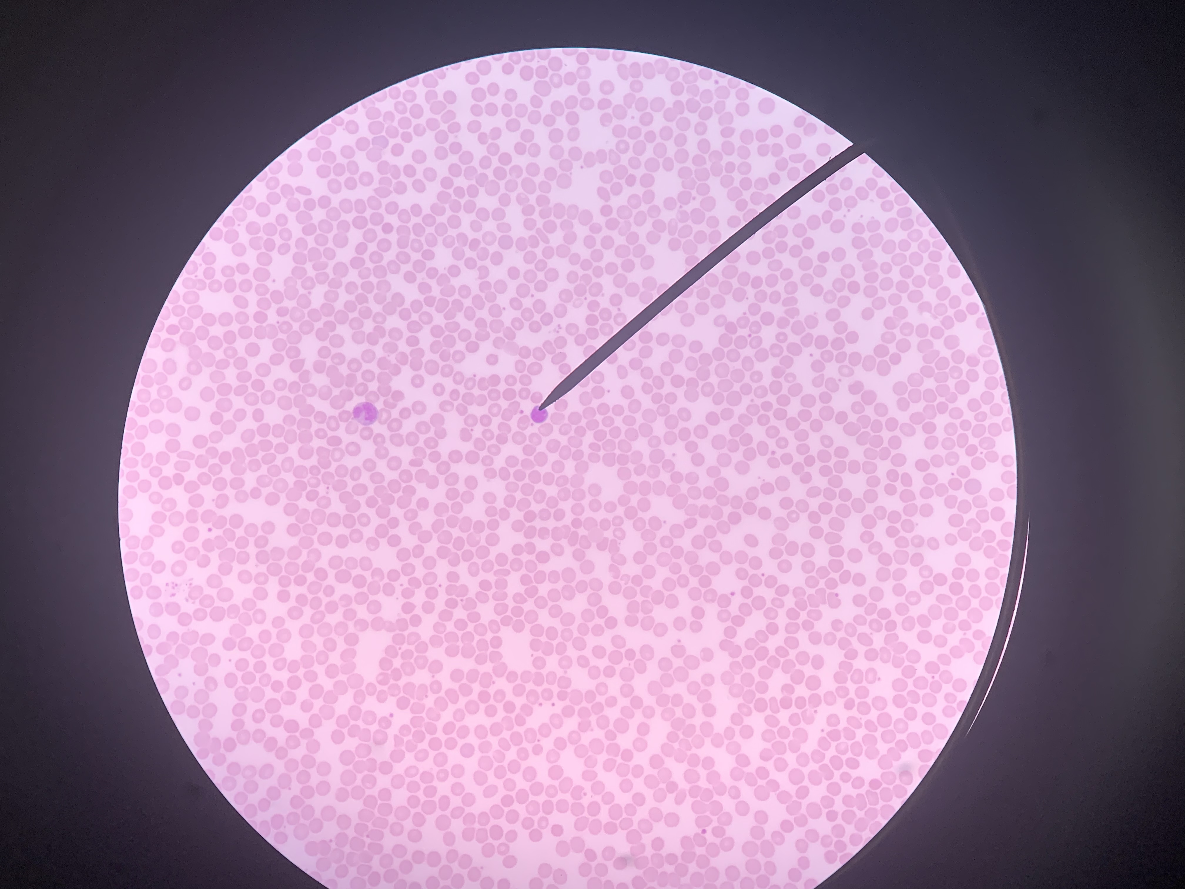 <p>Identify the blood cell at the tip of the pointer:</p>