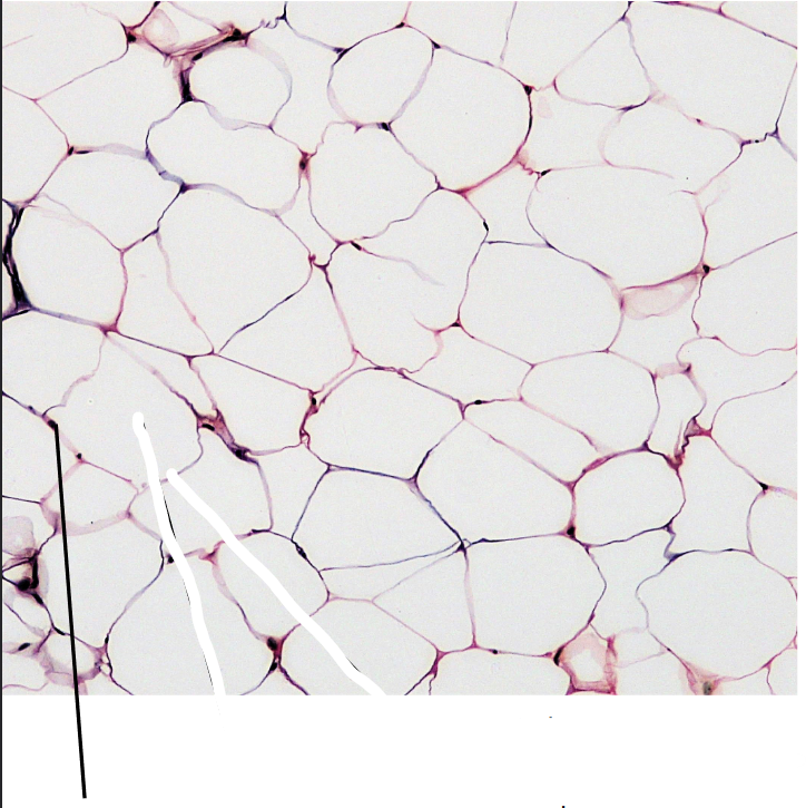<p>What part of the connective tissue is this?</p>