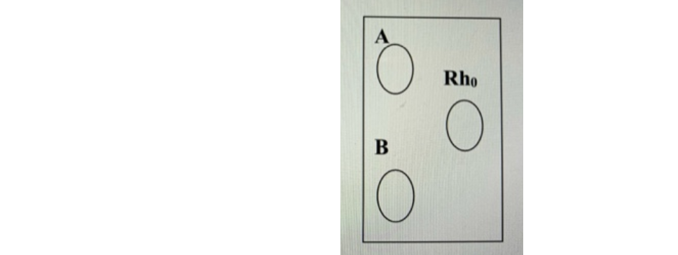 <p>what is this person’s blood type?</p>